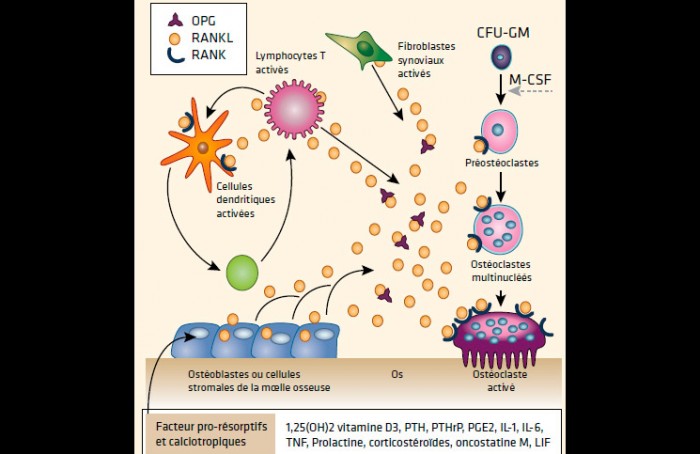 Effets osseux des biomédicaments au cours des rhumatismes inflammatoires - Les dernières données Effets osseux des biomédicaments au cours des rhumatismes inflammatoires - Les dernières données
