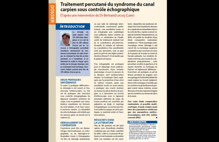 Traitement percutané du syndrome du canal carpien sous contrôle échographique Traitement percutané du syndrome du canal carpien sous contrôle échographique