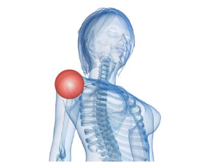 image-Spondyloarthrite périphérique-vers une prise en charge individualisée