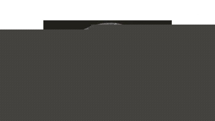 rhum118-polyarthrite-rhumatoide