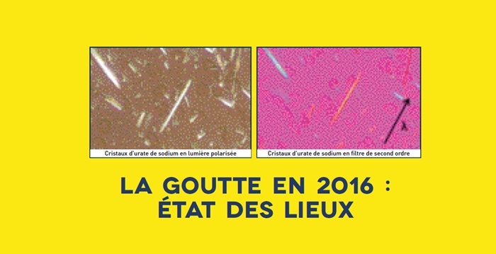 La goutte en 2016 : état des lieux