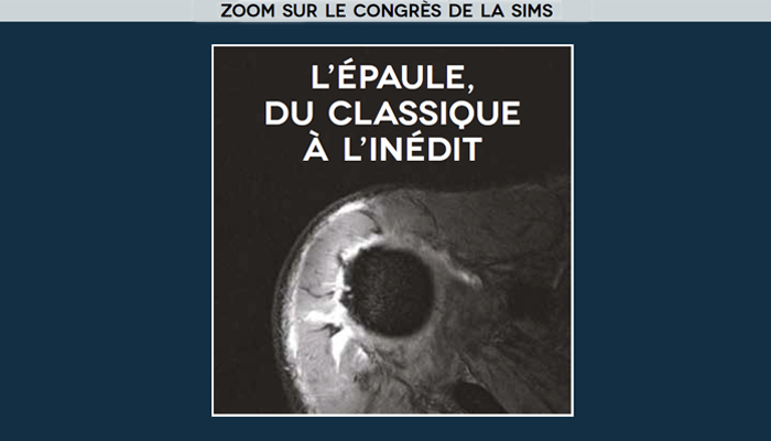 L’épaule, du classique à l’inédit : retour sur le congrès de la SIMS, juin 2016