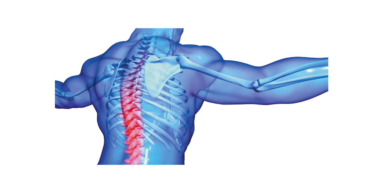 Spondyloarthrites non-radiographiques : particularités cliniques, évolutives et thérapeutiques