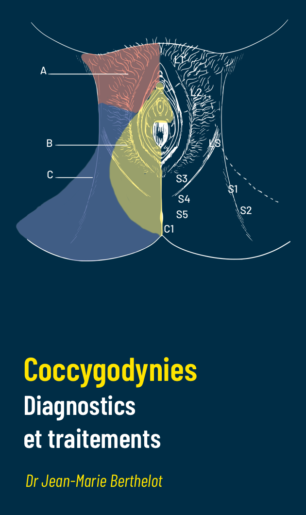 Coccygodynies : diagnostics et traitements
