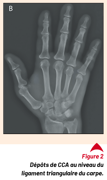 Cas clinique : Une maladie de Horton ?