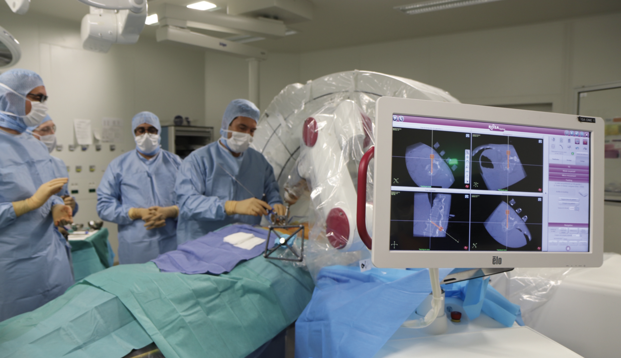 Biopsies vertébrales assistées par robot : les rhumatologues doivent (re)prendre la main