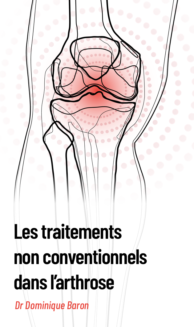 Traitements non conventionnels dans l’arthrose : point sur la littérature