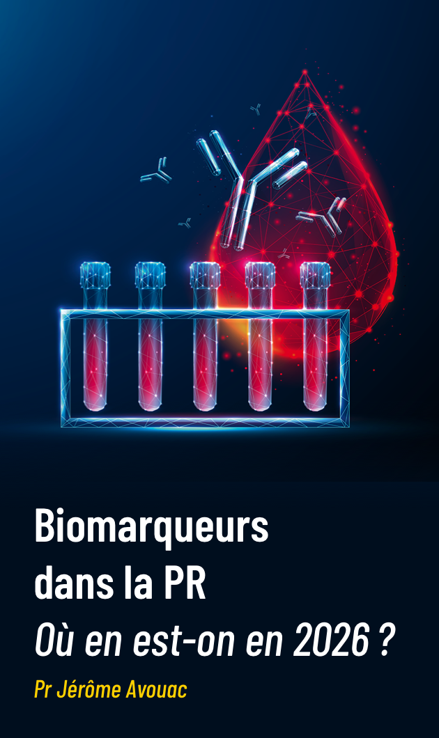 Biomarqueurs dans la polyarthrite rhumatoïde : où en est-on en 2026 ?